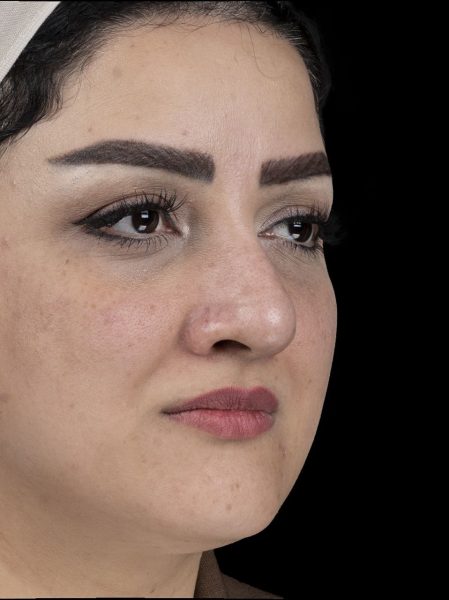 تصویر قبل از عمل