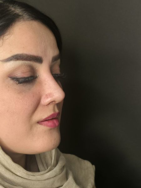 تصویر بعد از عمل