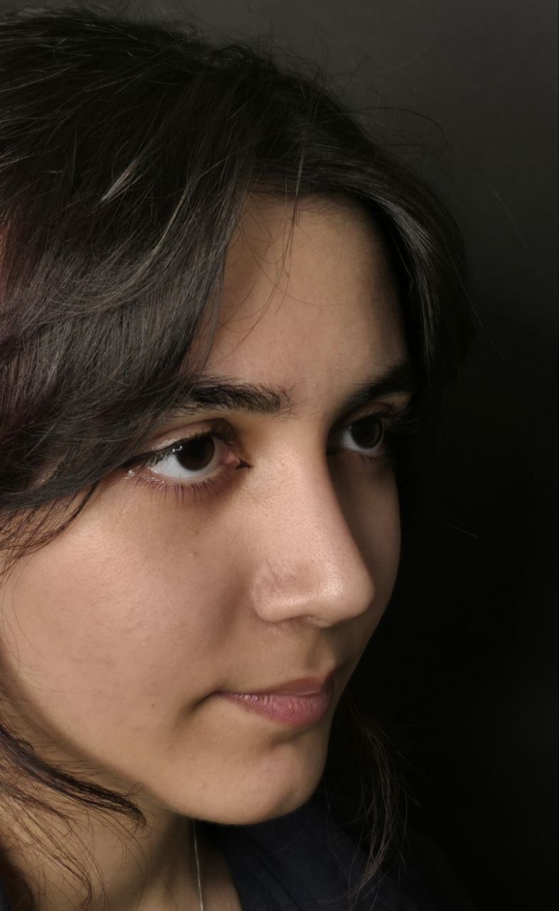 تصویر بعد از عمل